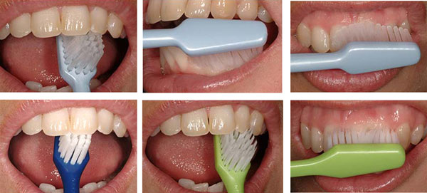 مسواک زدن صحیح را باید یاد گرفت و آن را به درستی انجام داد