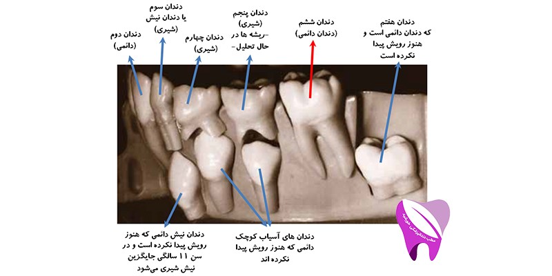 دندان دائمی کودکان و اهمیت چگونگی رشد آنها