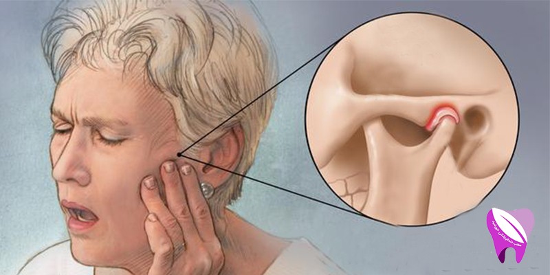 آیا میدانید درد فک چه مشکلاتی به همراه دارد ؟