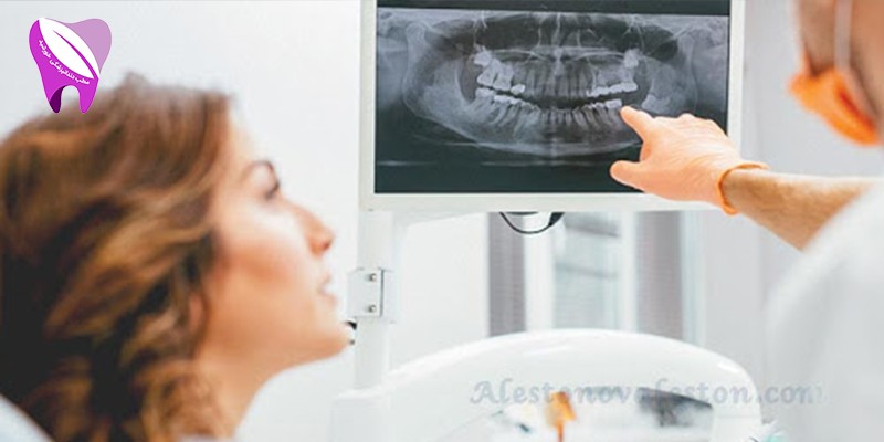 از عکس CBCT چه استفاده هایی میشود ؟