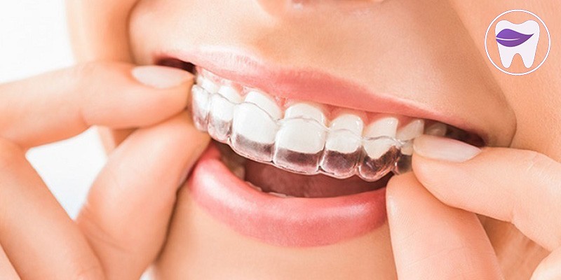 نایت گارد چه کاربرد و ویژگی هایی دارد ؟ 2 روش استفاده از نایت گارد چگونه است ؟