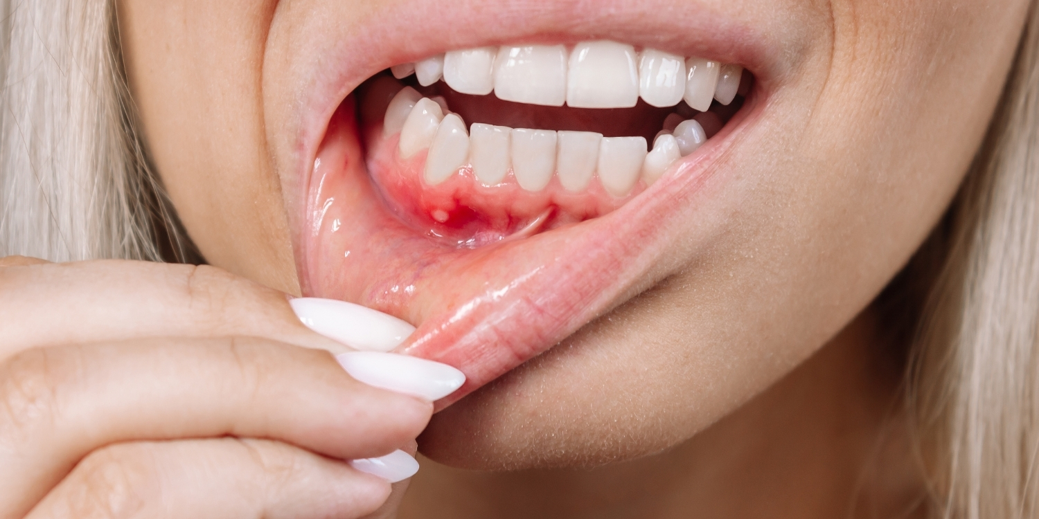 اهمیت تغذیه در حفظ سلامت لثه‌