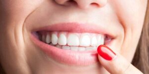 نکات مراقبتی جراحی افزیش طول تاج دندان