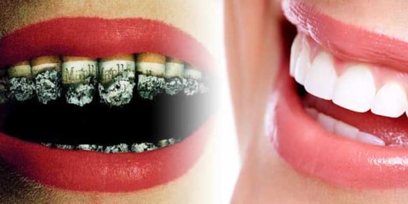عوارض سیگار کشیدن بر دندانها یکی از صدها مشکلاتی است که برای سلامت بدن به وجود می آورد