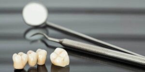 روکش دندان چگونه انجام میشود ؟