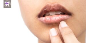 آیا میدانید خشکی دهان چه نشانه ها و علایمی دارد ؟