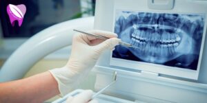 عکس CBCT چه مشکلاتی از وضعیت دهانی را نشان میدهد