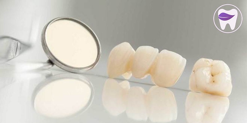 روکش زیرکونیا چه ویژگی های مثبت و منفی دارد ؟