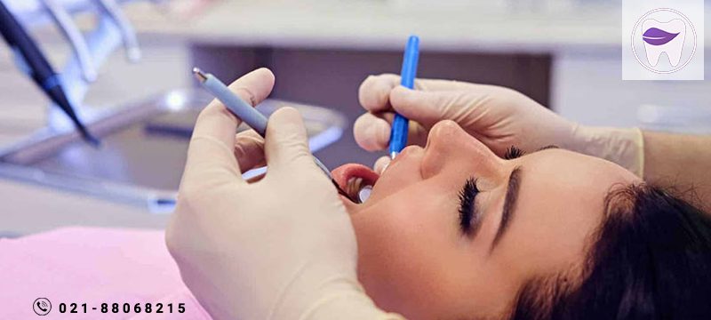 سدیشن در دنداپزشکی چه معنایی دارد ؟
