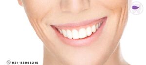 اصلاح لبخند لثه ای با لیزر چگونه انجام میشود ؟