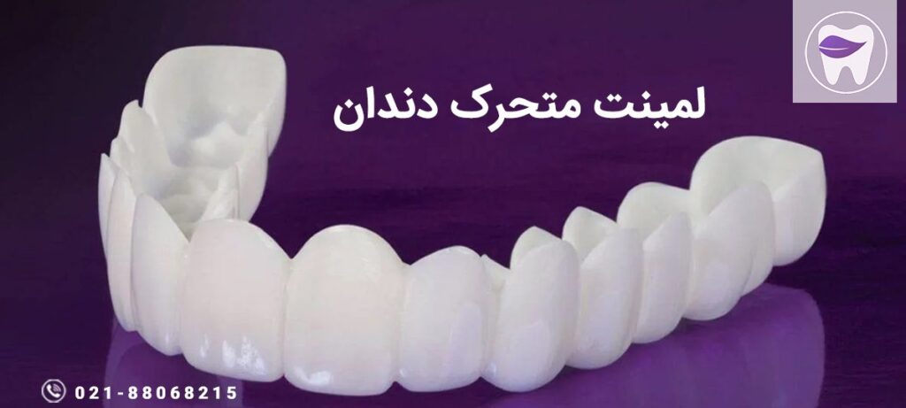 از لمینت متحرک دندان چه اطلاعاتی دارید ؟