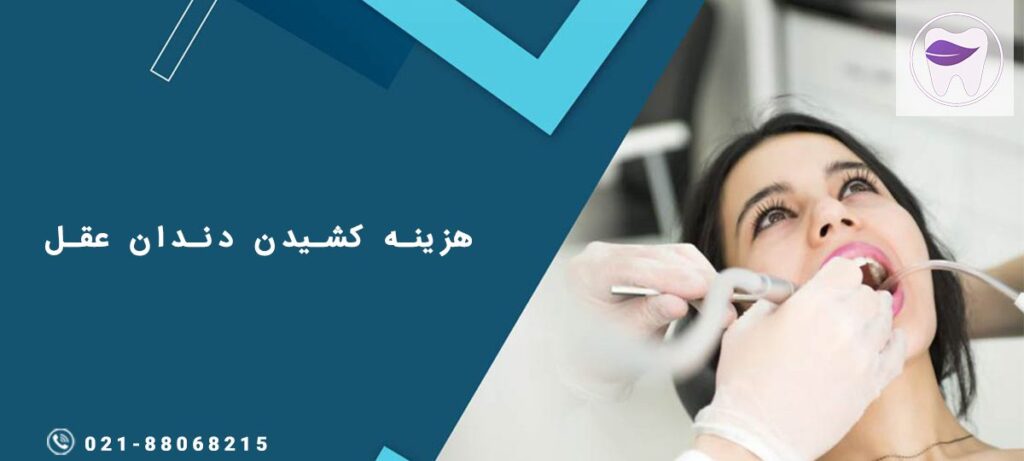 هزینه کشیدن دندان عقل در سال جدید چه میزان است ؟