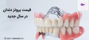 قیمت پروتز دندان چه میزانی است ؟