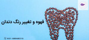 نوشیدن قهوه یکی از علل مهم در تغییر رنگ دندان افراد است