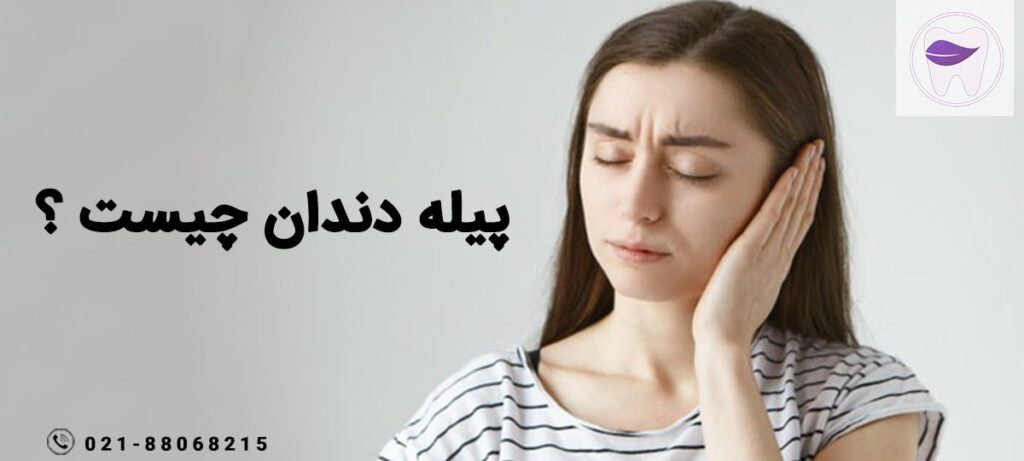 پیله دندان چیست ؟