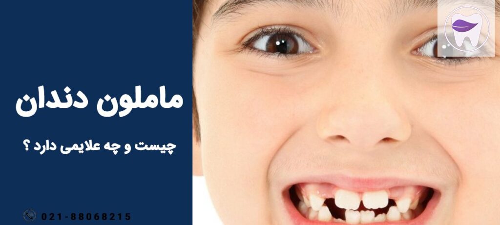 ماملون دندان چه لایمی دارد ؟