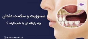 سینوزیت چه تاثیری در سلامت دندان ها دارد ؟