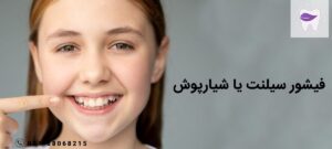 همه چیز در رابطه با فیشور سیلنت یا شیارپوش
