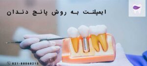 بایدها و نبایدهای ایمپلنت به روش پانچ دندان که لازم است بدانید