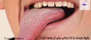 پاپیلا چیست و آیا درمانی برای آن وجود دارد ؟