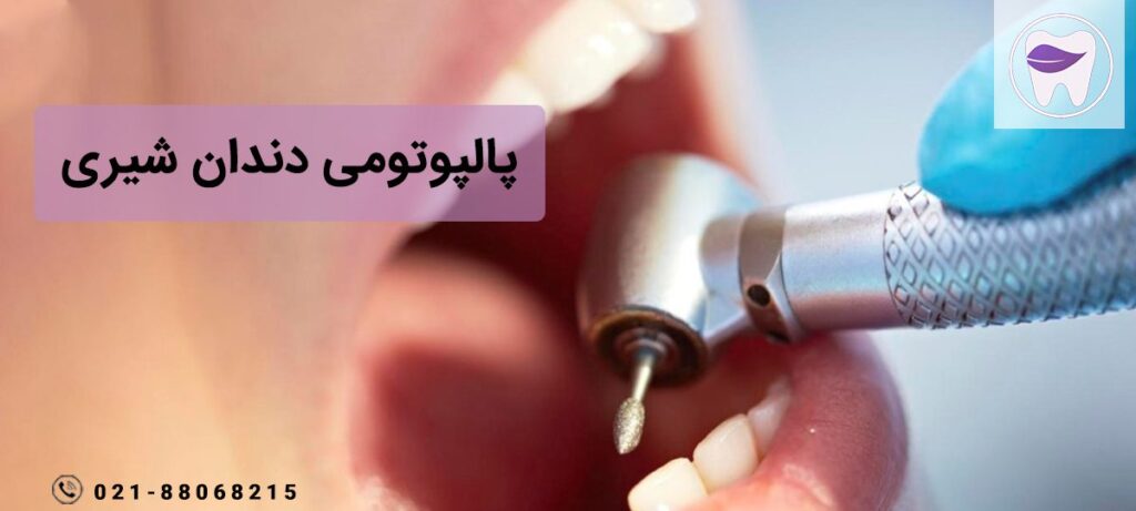 پالپوتومی یک روش در درمان دندان کودکان