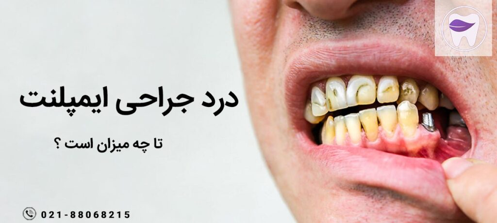 مهم ترین علل درد جراحی ایمپلنت چیست ؟