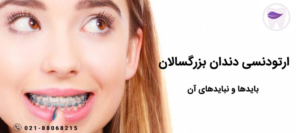 ارتودنسی دندان بزرگسالان چگونه انجام میشود ؟