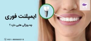 ایمپلنت فوری چه ویژگی ها و نکاتی دارد ؟