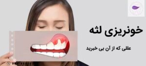 علل شایع خونریزی لثه که کمتر شنیده اید !