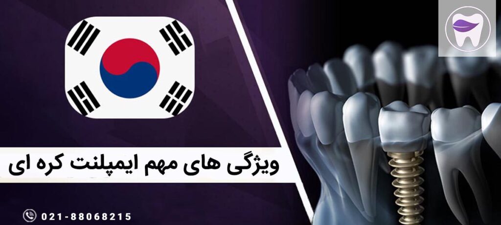 ویژگی های مهم ایمپلنت کره ای که باید بدانید