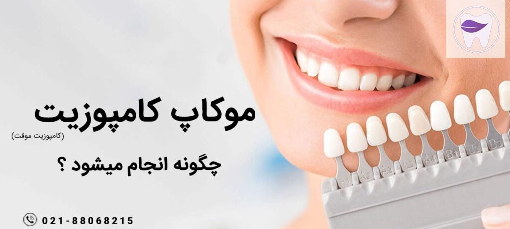 همه چیز درباره روش انجام موکاپ کامپوزیت