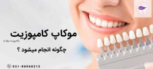 همه چیز درباره روش انجام موکاپ کامپوزیت