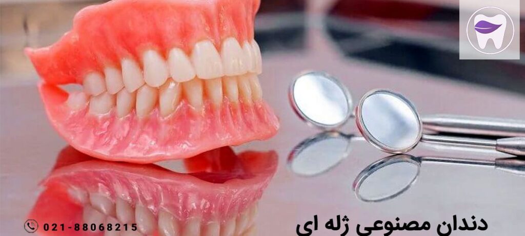 نکاتی که لازم است از دندان مصنوعی ژله ای بدانید