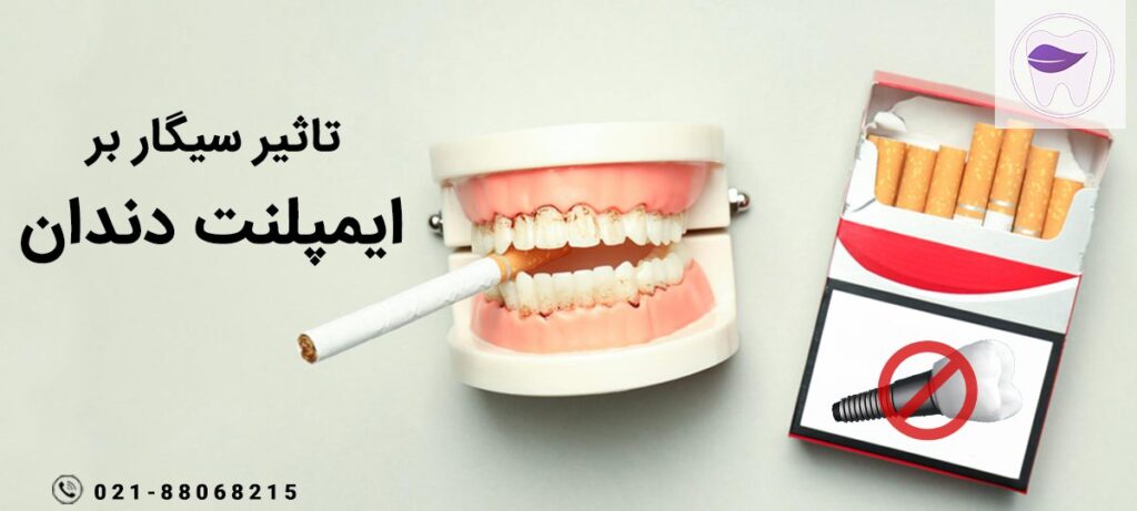 تاثیر و رابطه کشیدن سیگار و ایمپلنت دندان که باید بدانید