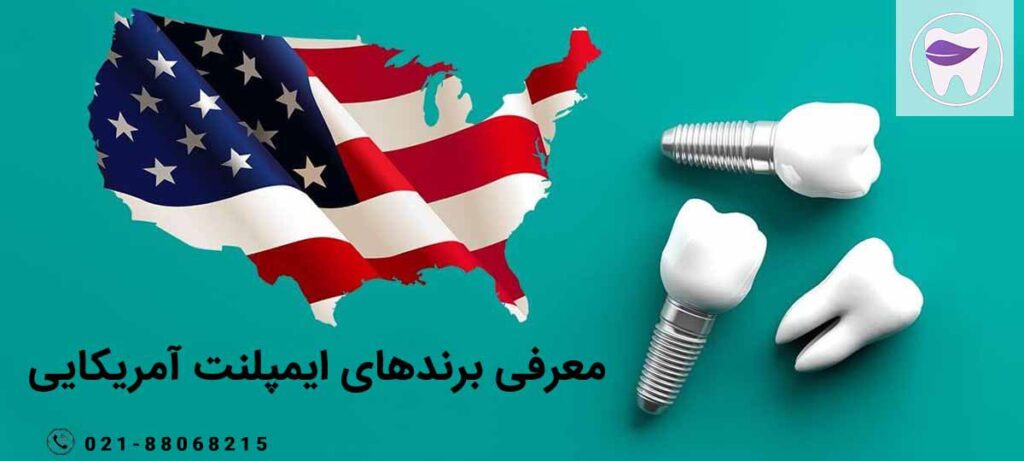 بهترین برندهای ایمپلنت آمریکایی کدام هستند ؟
