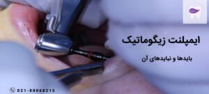همه چیز در رابطه با ایمپلنت زیگوماتیک کچه زمانی مورد استفاده است ؟
