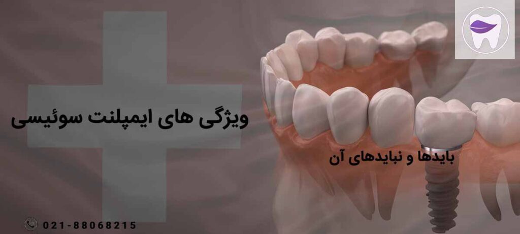 ایمپلنت سوئیسی چه ویژگی های مهمی دارد ؟