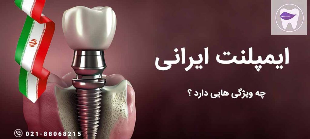 ایمپلنت ایرانی چه ویژگی ها و خصوصیاتی دارد ؟