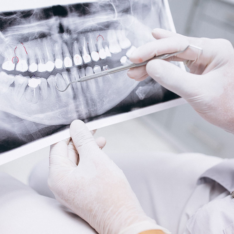 خدمات ترمیم