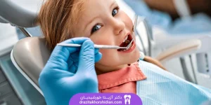 بهترین روش های پر کردن دندان کودکان‌ + مراحل و نکات