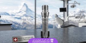 بهترین ایمپلنت سوئیسی