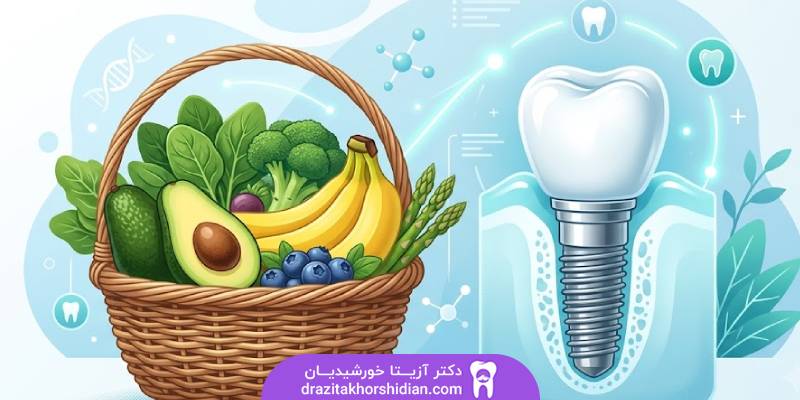 غذا خوردن بعد ایمپلنت