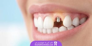 هیلینگ اباتمنت