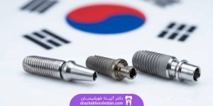بهترین برند ایمپلنت کره‌ ای
