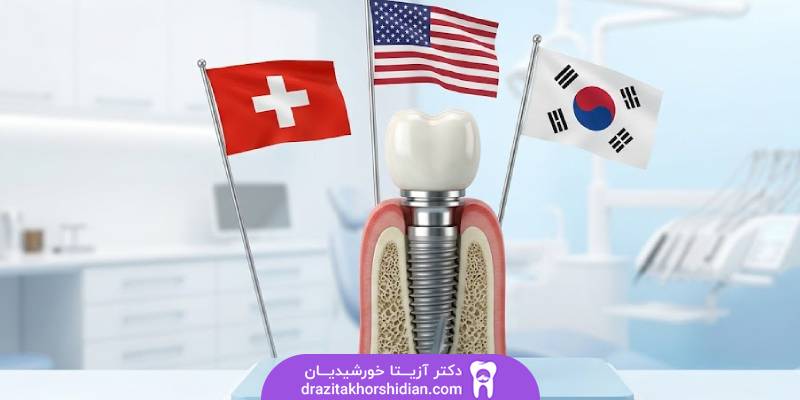 بهترین ایمپلنت‌ کدام است؟