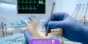 ایمپلنت بیماران قلبی